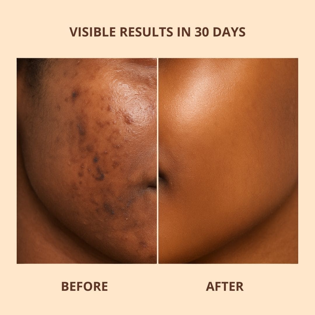 Brightening Pads with Turmeric and Kojic Acid