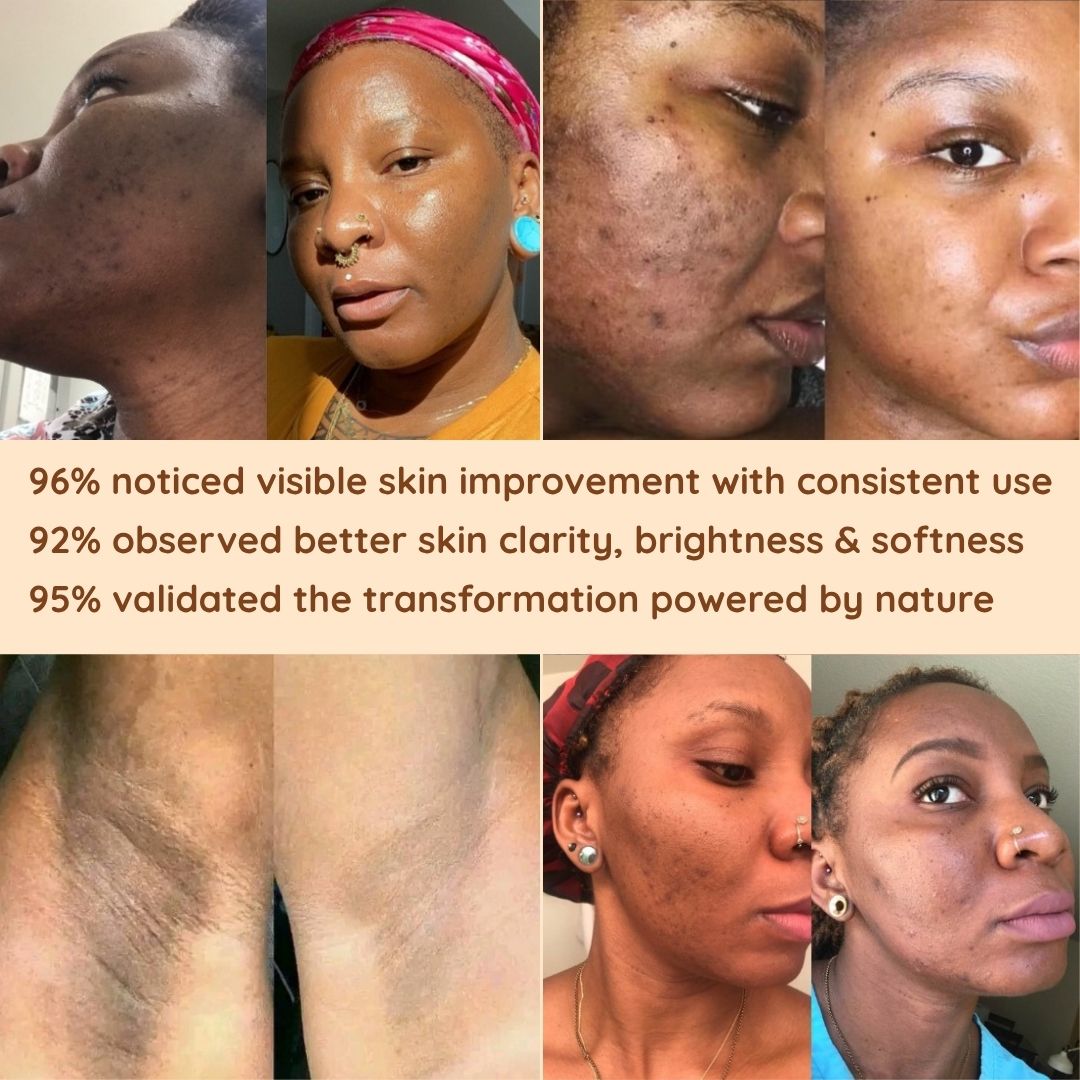 Brightening Pads with Turmeric and Kojic Acid