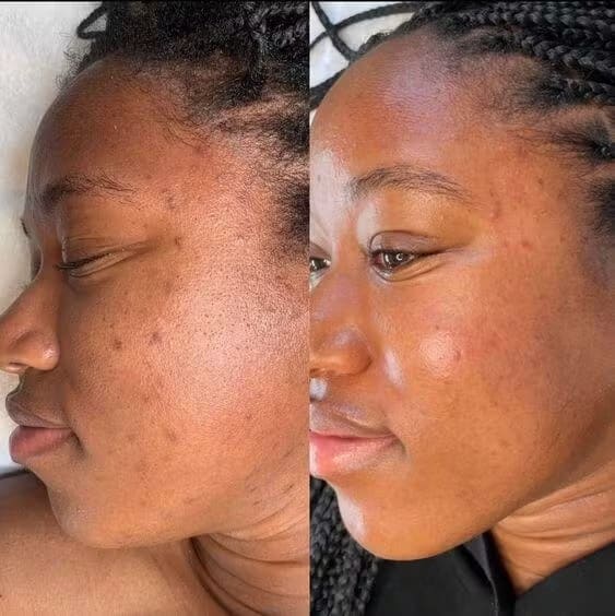 Brightening Pads with Turmeric and Kojic Acid