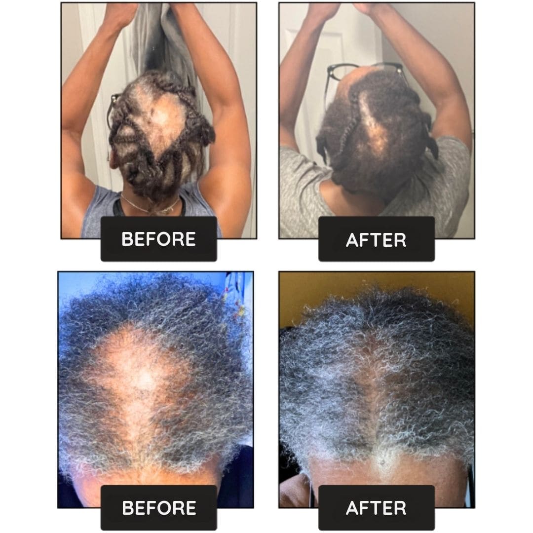 Hair Growth Boost Serum