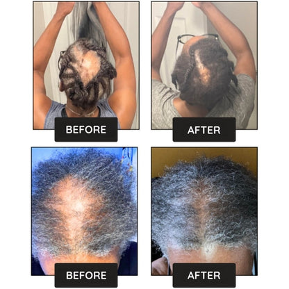 Hair Growth Boost Serum