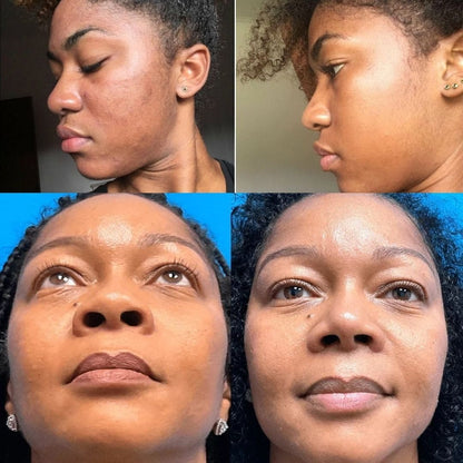 PCOS Balance+ Hormonal balance, regular cycles, clear skin