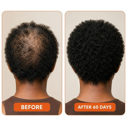 Super Food Premium Seaweed - Stronger, Fuller Hair & Healthy Growth