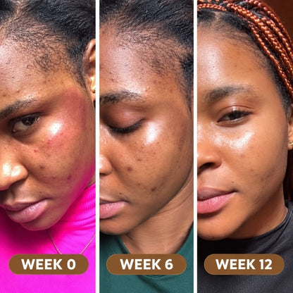 Super Food Premium Seaweed - Clearer, Brighter Skin & Dark Spot Support