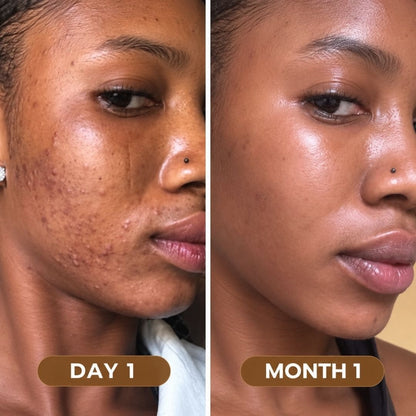 Super Food Premium Seaweed - Clearer, Brighter Skin & Dark Spot Support