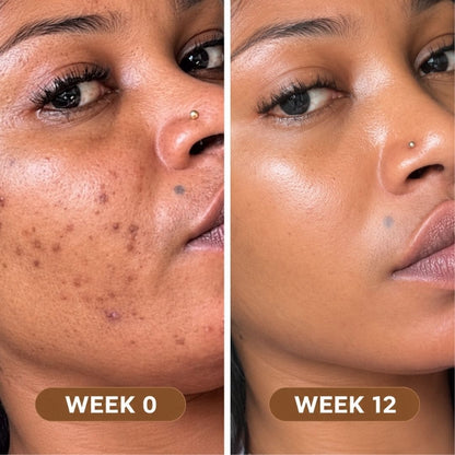Super Food Premium Seaweed - Clearer, Brighter Skin & Dark Spot Support