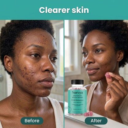 PCOS Balance+ Hormonal balance, regular cycles, clear skin