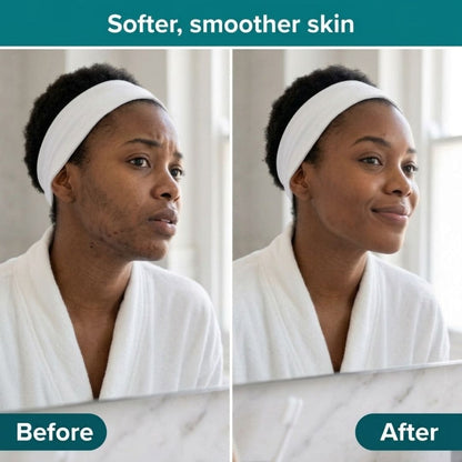 PCOS Balance+ Hormonal balance, regular cycles, clear skin