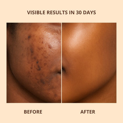 Brightening Pads with Turmeric and Kojic Acid
