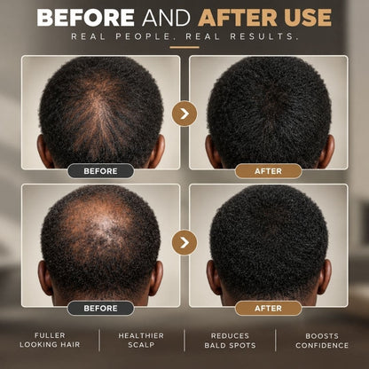 Men Hair Growth Boost Serum