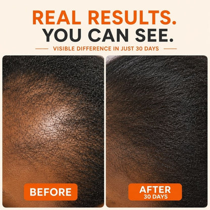 Super Food Premium Seaweed - Stronger, Fuller Hair & Healthy Growth