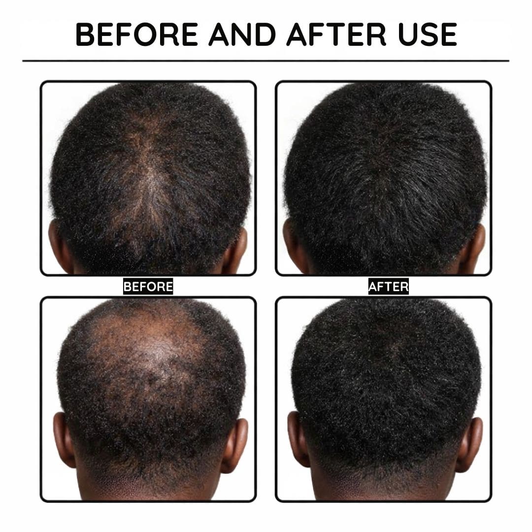 Hair Growth Boost Serum