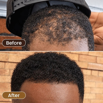 Men Hair Growth Boost Serum