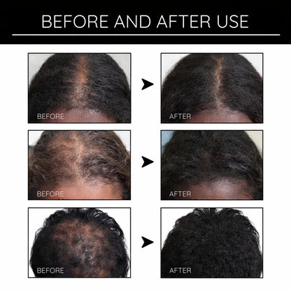Hair Growth Boost Serum