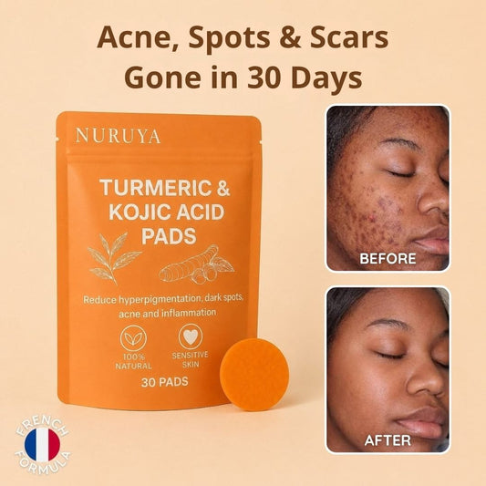 Golden Glow Pads — Turmeric & Kojic Acid (SPECIAL OFFER)