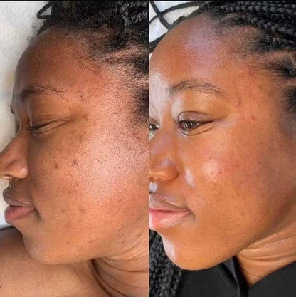 Brightening Pads with Turmeric and Kojic Acid