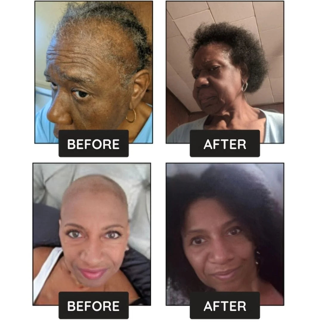 Hair Growth Boost Serum