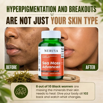 Super Food Premium Seaweed - Clearer, Brighter Skin & Dark Spot Support